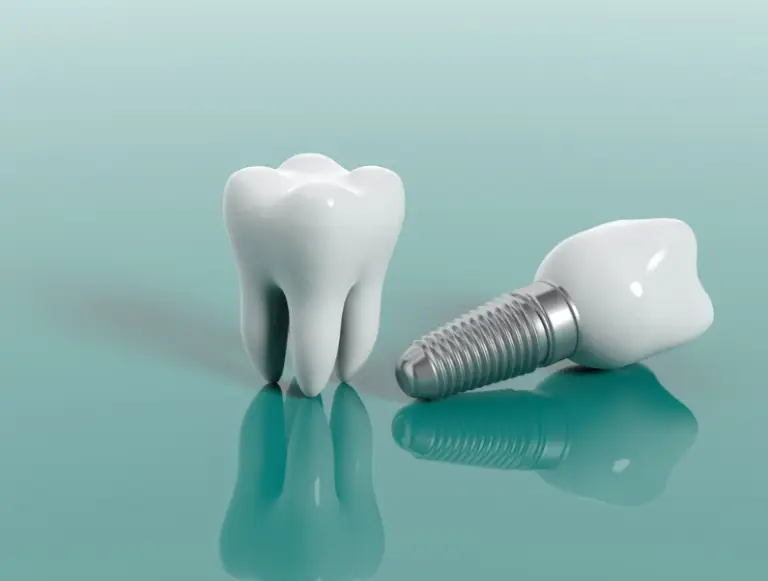Dental Implants