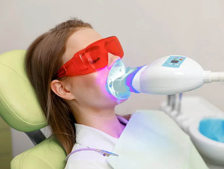 Teeth Whitening