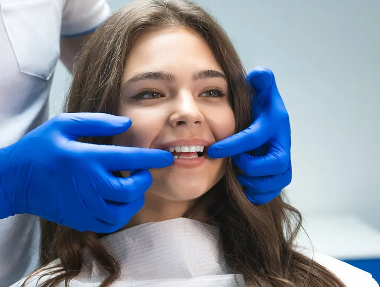 The Benefits of Prepless Veneers