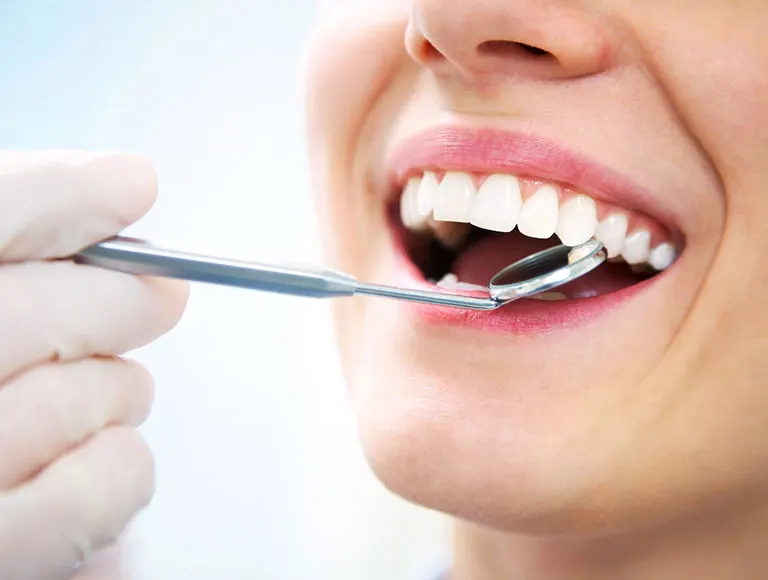 What is the Process for Teeth Whitening?