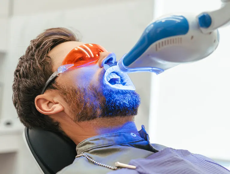 How Long do Teeth Whitening Results Typically Last?