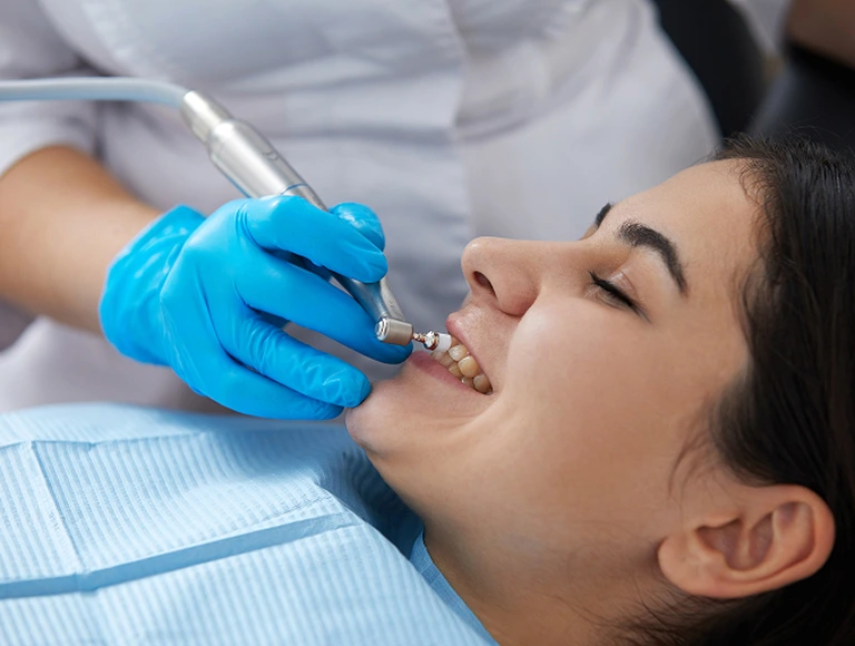 Dental Checkups & Teeth Cleanings