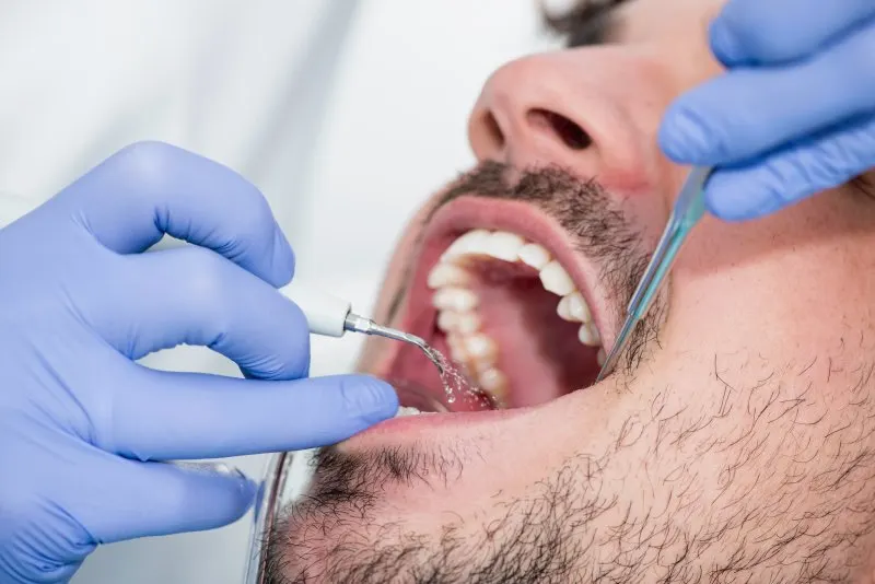 man at a dental cleaning