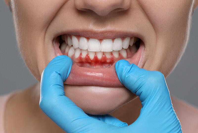 Bottom of Chewing Gum